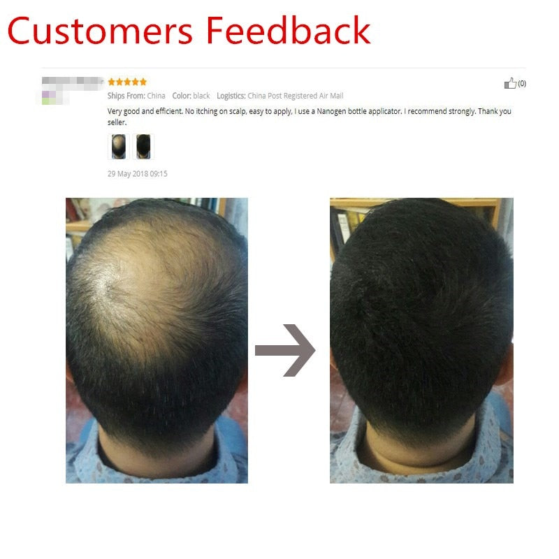 Pó Anticalvice HairFiber FluffUp